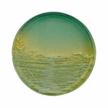 agar nutritivo iso
