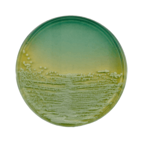 agar nutritivo iso