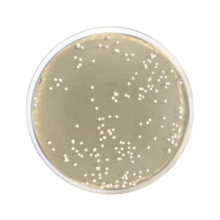 Agar Dextrosa Sabouraud con Cloranfenicol