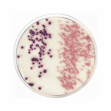 Agar Cromogénico Coliformes