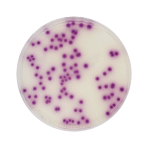 Agar Cromogénico para Salmonella